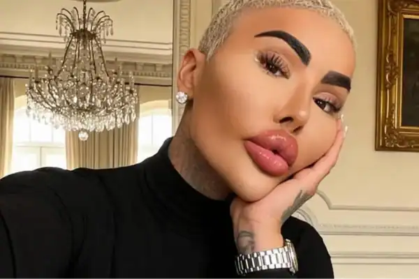 Influenciadora que buscava visual de Kim Kardashian tem morte confirmada