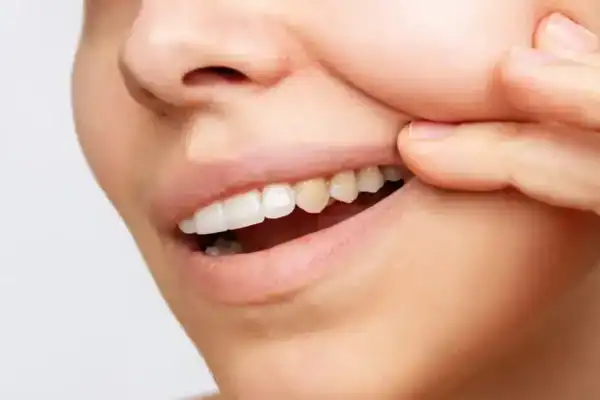 Glenhuntly Dental Clinic na Austrália aponta hábitos diários que amarelam os dentes