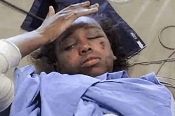 Bahia Bakari, única sobrevivente do voo Yemenia Flight 626 que caiu no Oceano Índico