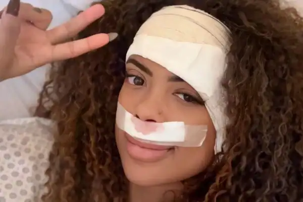 Marvvila é submetida a cirurgia para remoção de tumor no ouvido e correção de septo nasal