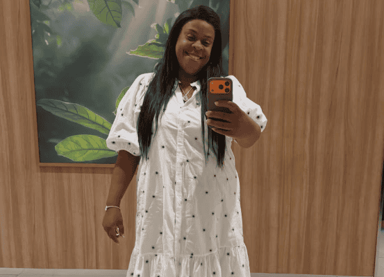 Cacau Protásio sofre perda temporária da visão após usar pomada capilar