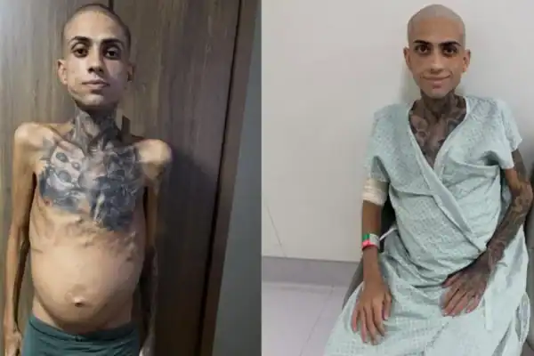 Influenciador Jota Surfista morre aos 30 anos após luta contra câncer no estômago