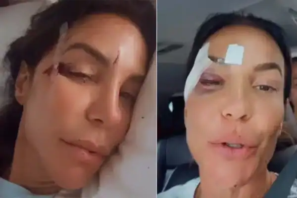 Confira o estado de saúde de Ivete Sangalo após cirurgia