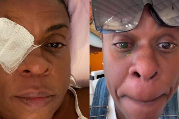 Cacau Protásio tem perda de visão após usar pomada de cabelo