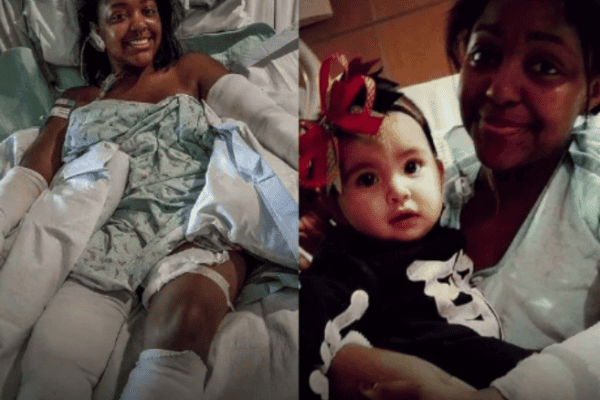 Mulher usa o próprio como escudo e leva 40 mordidas de pit bull para salvar bebê de 8 meses