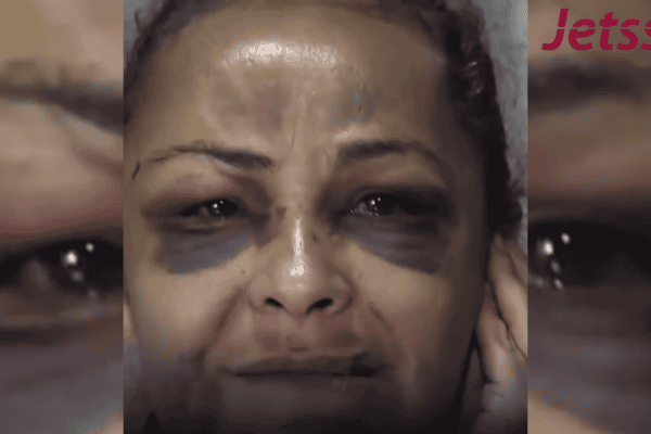 Mulher espancada pelo ex implora por socorro após ataque: “Vai ter que esperar me matar para prender”