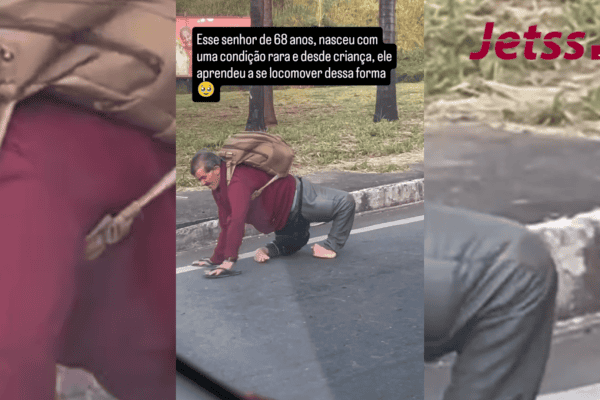 Um senhor de 68 anos nasceu com uma condição rara e, desde criança, aprendeu a se locomover dessa forma