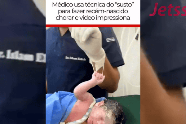 Médico usa técnica do “susto” para fazer recém-nascido chorar e vídeo impressiona