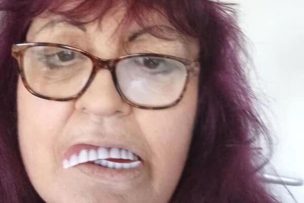 Idosa é enganada e fica com ‘sorriso’ inusitado após gastar R$ 100