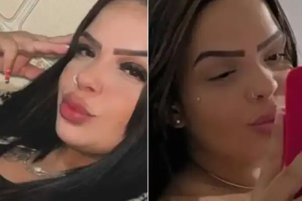 Mulher morre dias após extração de dente do siso e caso é investigado