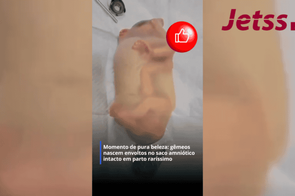 Momento de pura beleza: gêmeos nascem envoltos no saco amniótico intacto em parto raríssimo