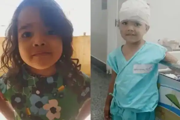 Menina de 4 anos sofre graves ferimentos na cabeça ao ser atacada por pit bull