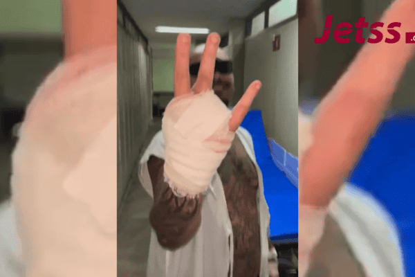 Streamer diz ter perdido dedo ao tentar invadir Rock in Rio e o leiloa